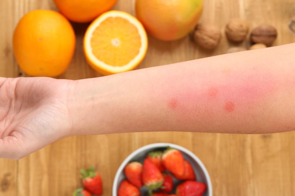 Alergia pokarmowa. Kobieta trzymająca rękę nad produktami na stole